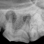 Tandkursus - dental bonding